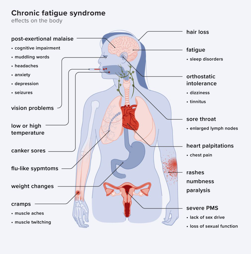 Chronic Fatigue Treatment Pune - Dr. Amol Dange
